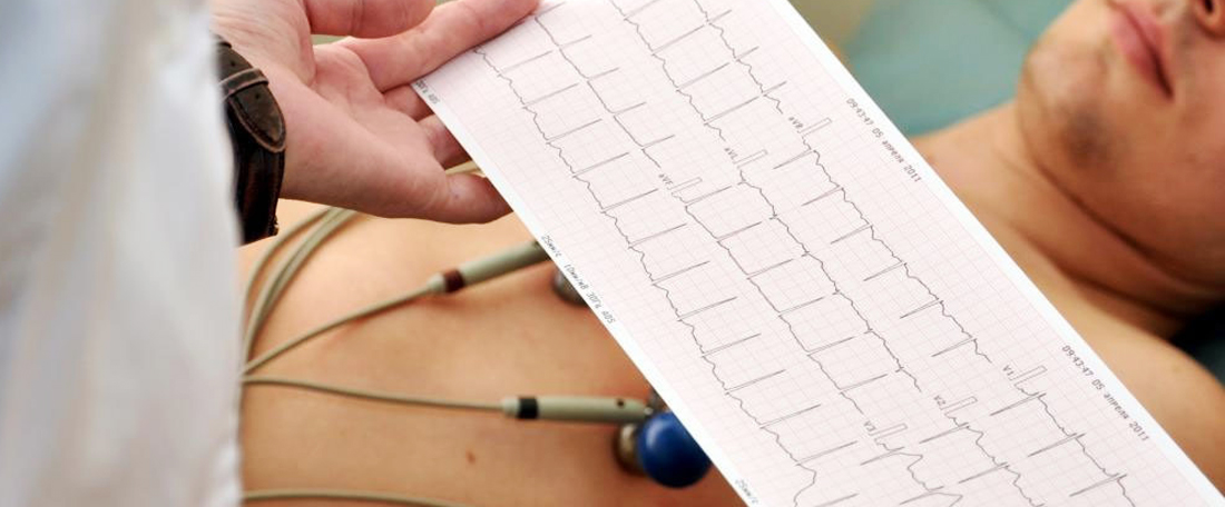 Eletrocardiograma (ECG)